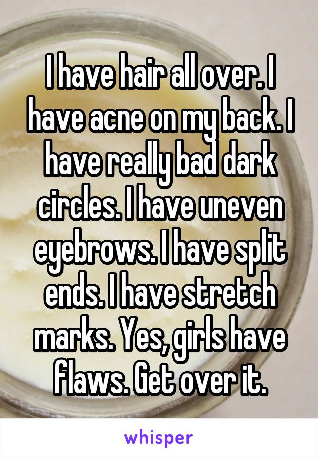 I have hair all over. I have acne on my back. I have really bad dark circles. I have uneven eyebrows. I have split ends. I have stretch marks. Yes, girls have flaws. Get over it.