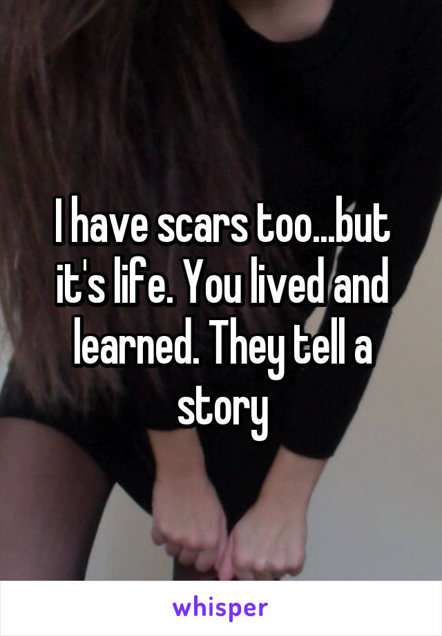 I have scars too...but it's life. You lived and learned. They tell a story