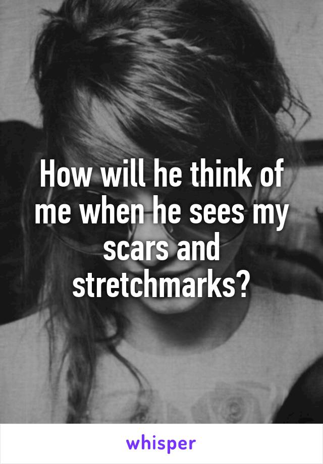 How will he think of me when he sees my scars and stretchmarks?