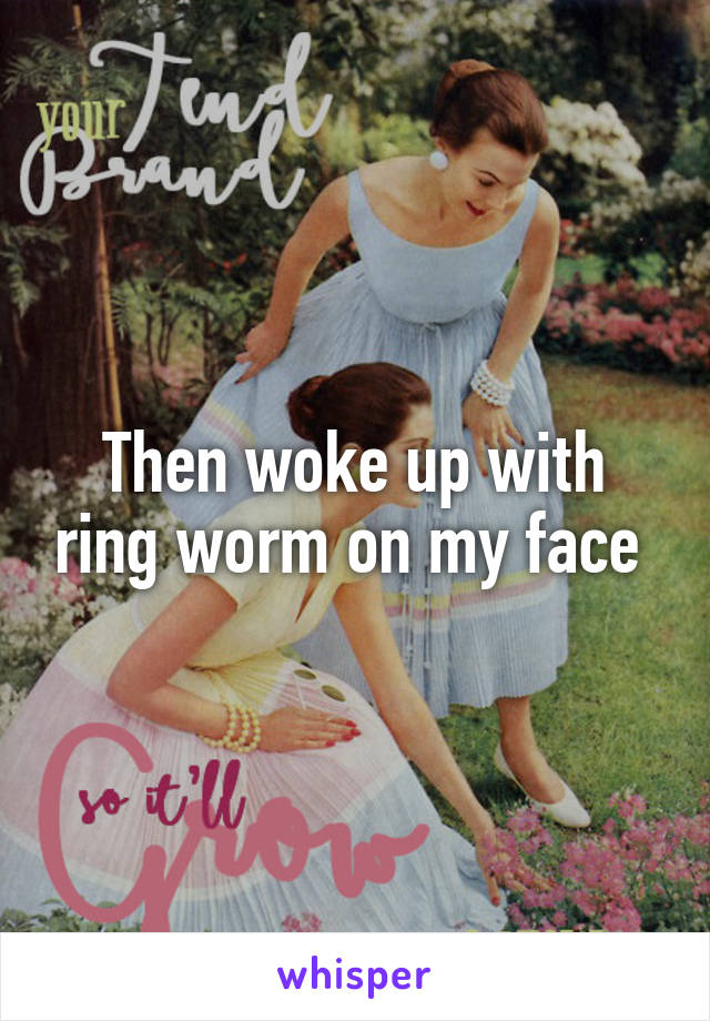 Then woke up with ring worm on my face 