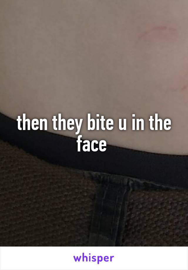 then they bite u in the face 