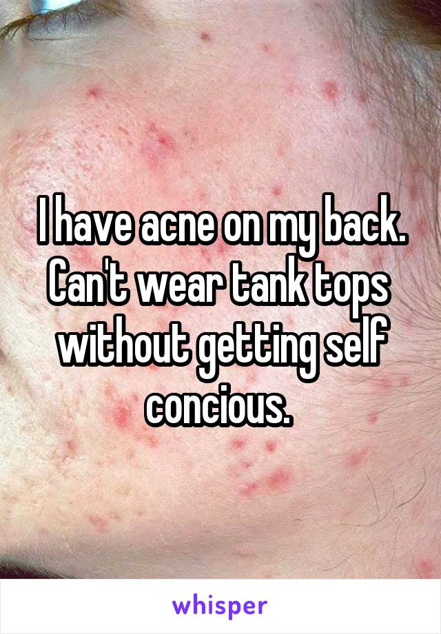 I have acne on my back. Can't wear tank tops  without getting self concious. 