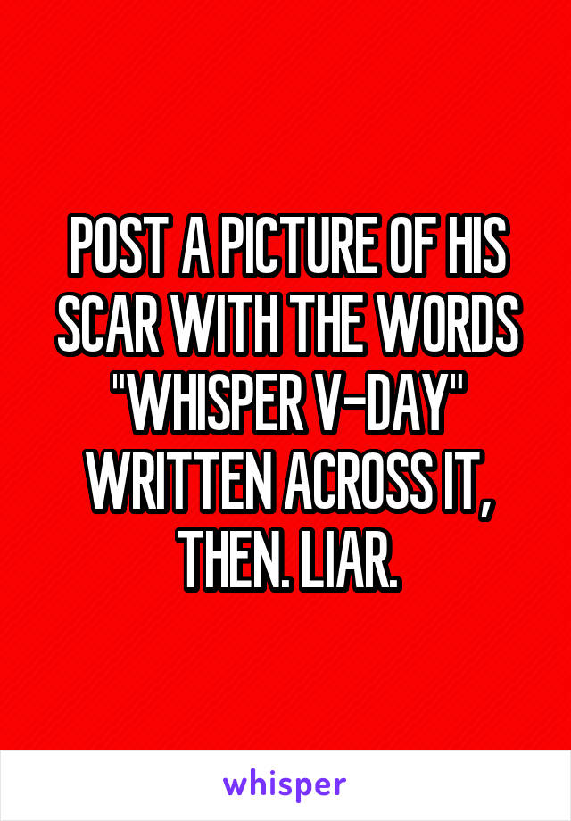 POST A PICTURE OF HIS SCAR WITH THE WORDS
"WHISPER V-DAY" WRITTEN ACROSS IT, THEN. LIAR.