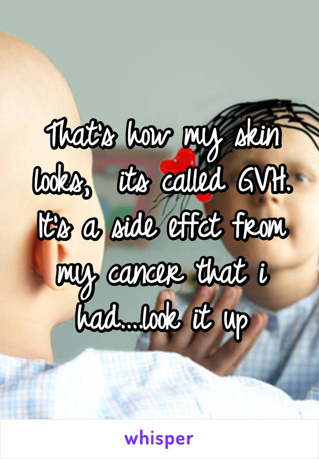 That's how my skin looks,  its called GVH. It's a side effct from my cancer that i had....look it up