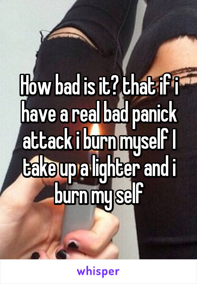 How bad is it? that if i have a real bad panick attack i burn myself I take up a lighter and i burn my self