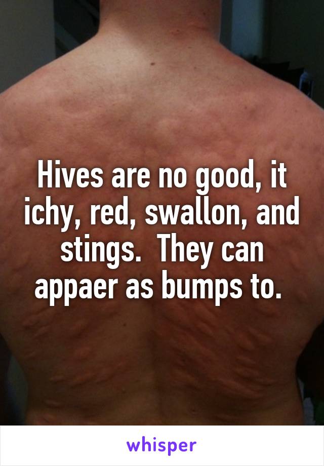 Hives are no good, it ichy, red, swallon, and stings.  They can appaer as bumps to. 