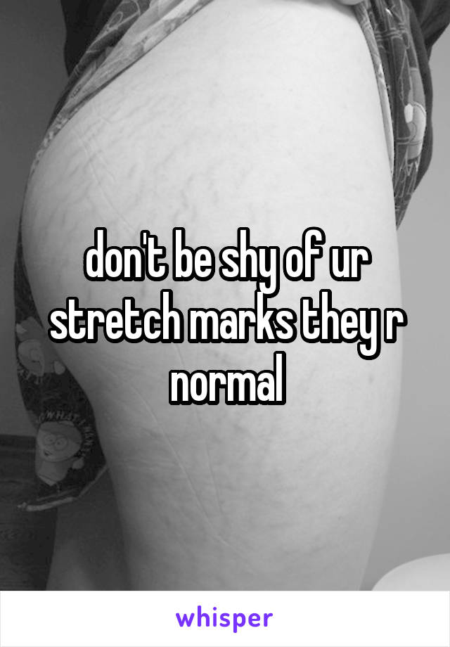 don't be shy of ur stretch marks they r normal