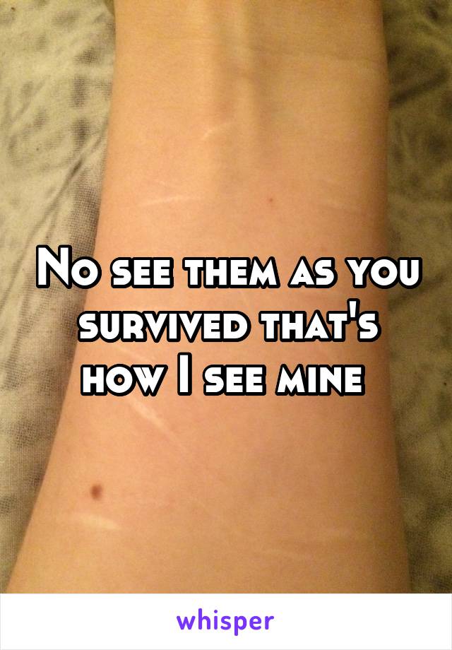 No see them as you survived that's how I see mine 