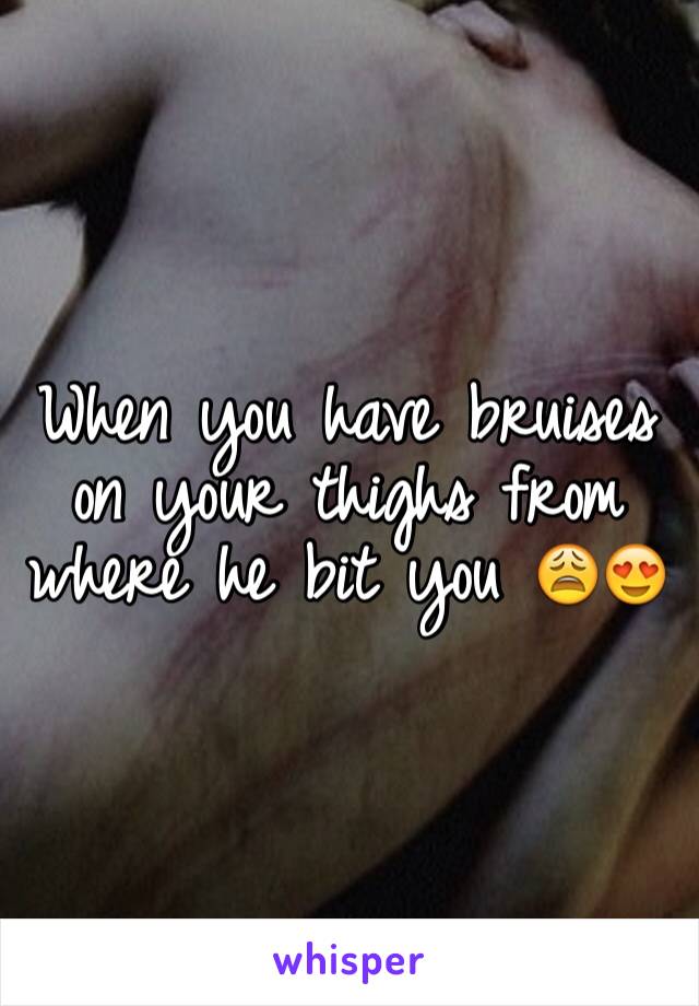 When you have bruises on your thighs from where he bit you 😩😍