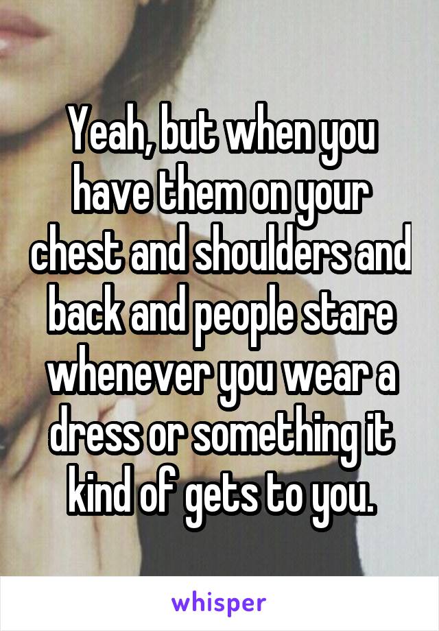 Yeah, but when you have them on your chest and shoulders and back and people stare whenever you wear a dress or something it kind of gets to you.