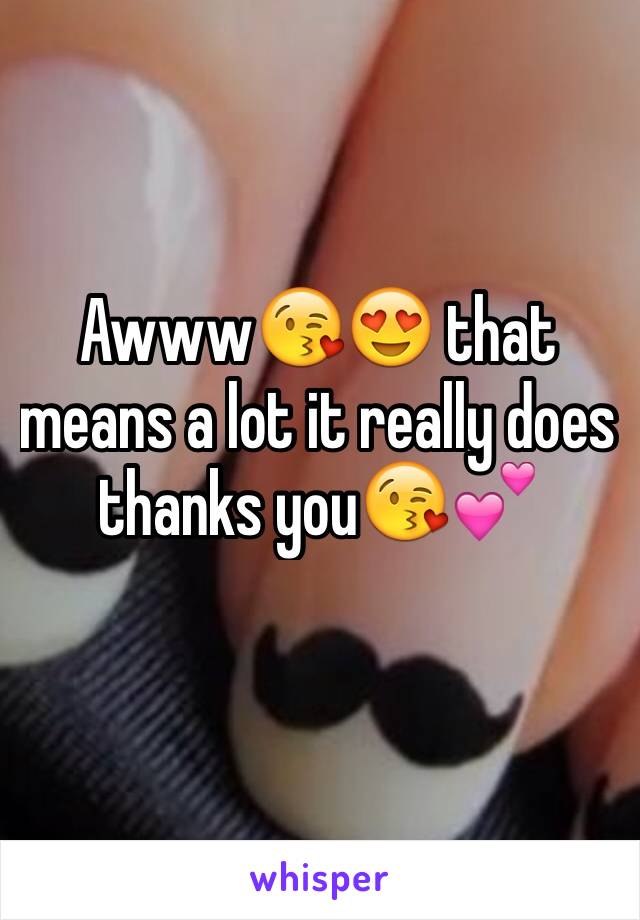 Awww😘😍 that means a lot it really does thanks you😘💕