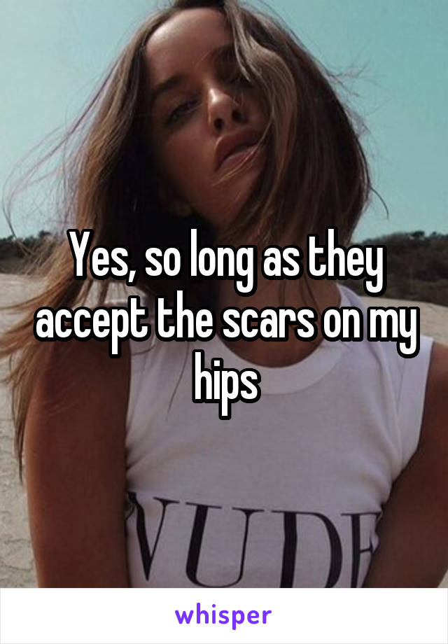 Yes, so long as they accept the scars on my hips