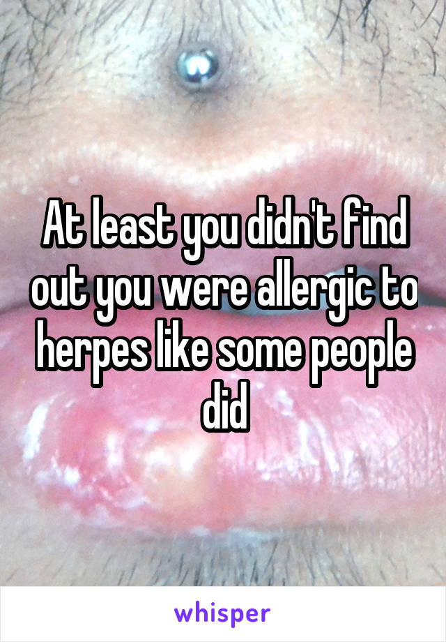 At least you didn't find out you were allergic to herpes like some people did
