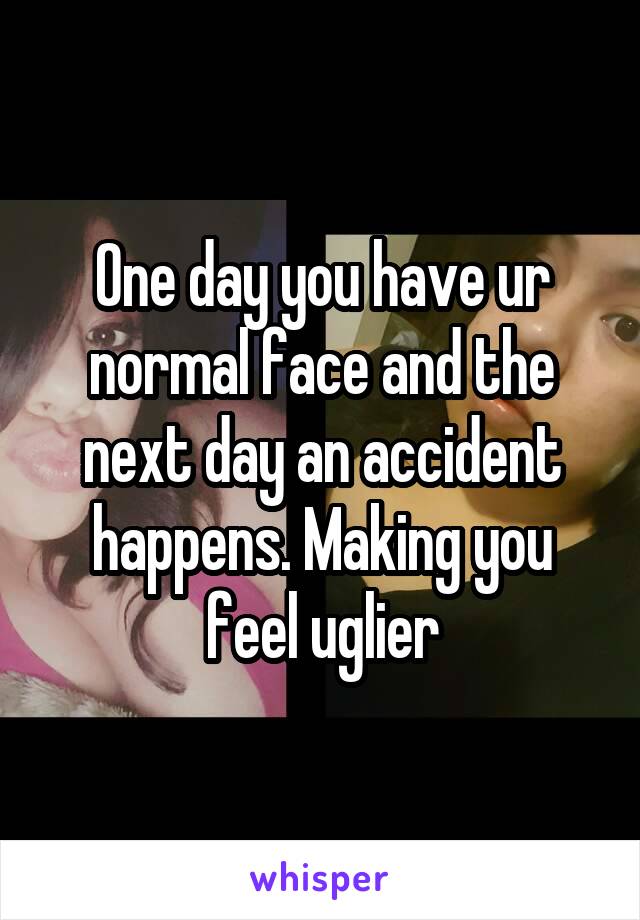 One day you have ur normal face and the next day an accident happens. Making you feel uglier
