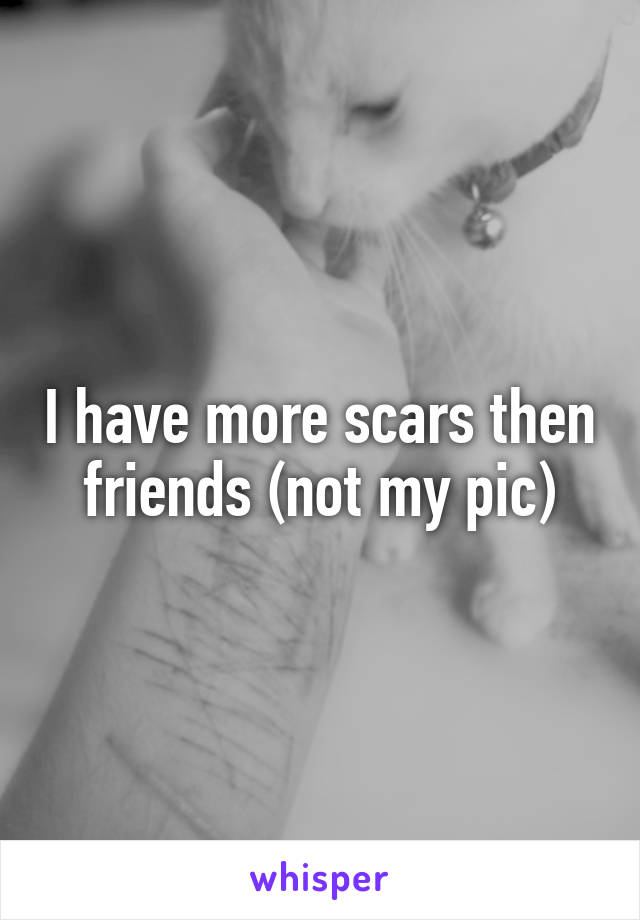 I have more scars then friends (not my pic)