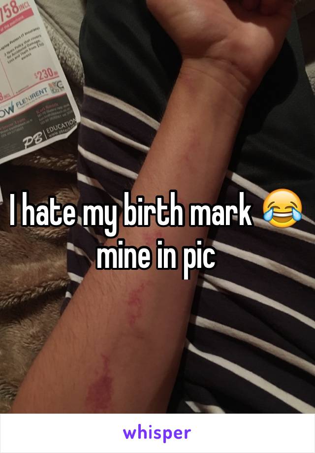 I hate my birth mark 😂 mine in pic 