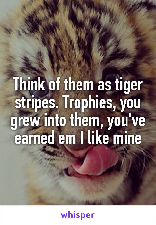 Think of them as tiger stripes. Trophies, you grew into them, you've earned em I like mine