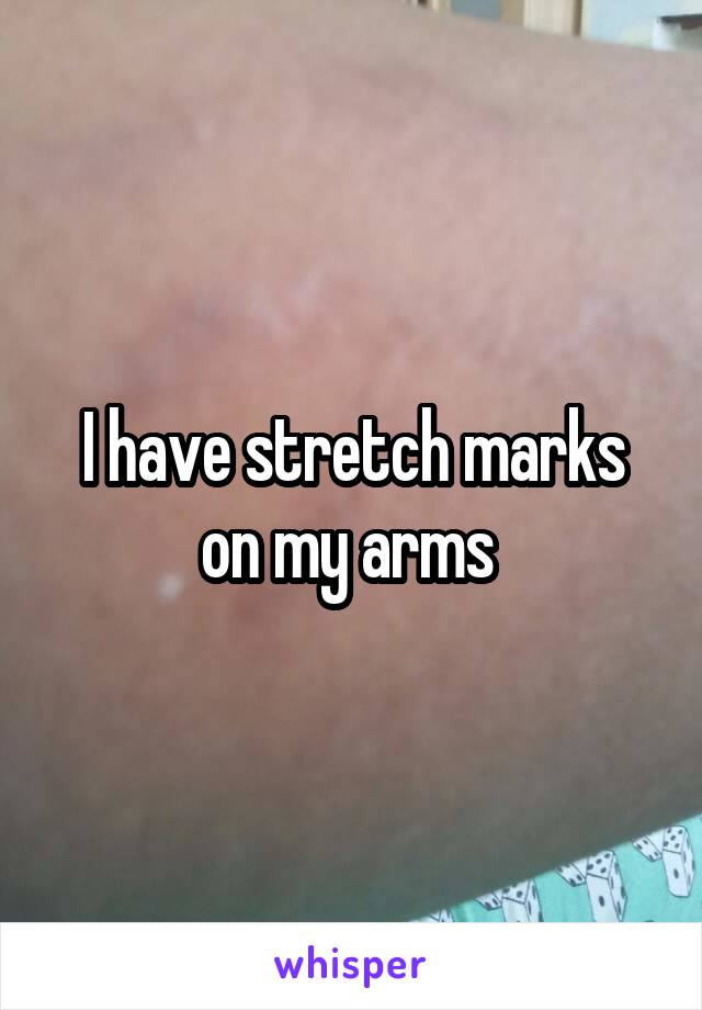 I have stretch marks on my arms 