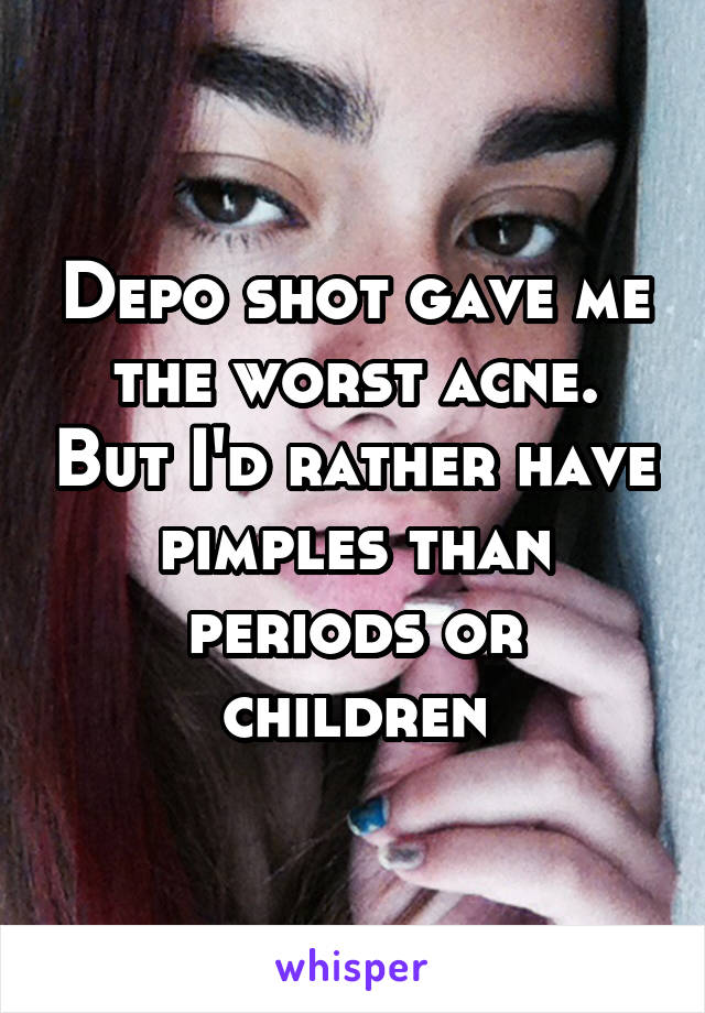 Depo shot gave me the worst acne. But I'd rather have pimples than periods or children
