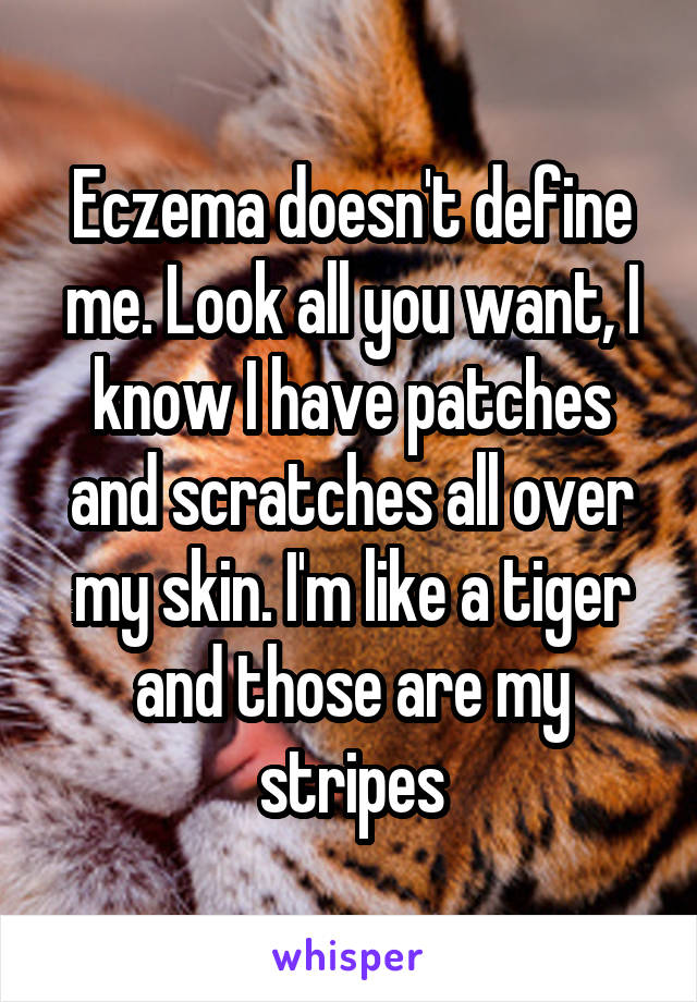 Eczema doesn't define me. Look all you want, I know I have patches and scratches all over my skin. I'm like a tiger and those are my stripes