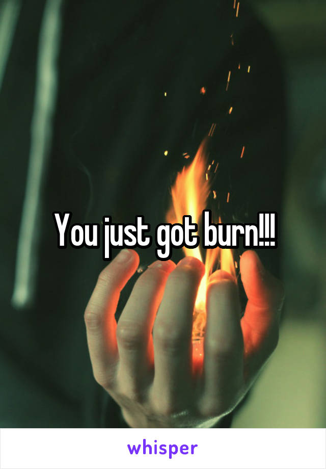 You just got burn!!!