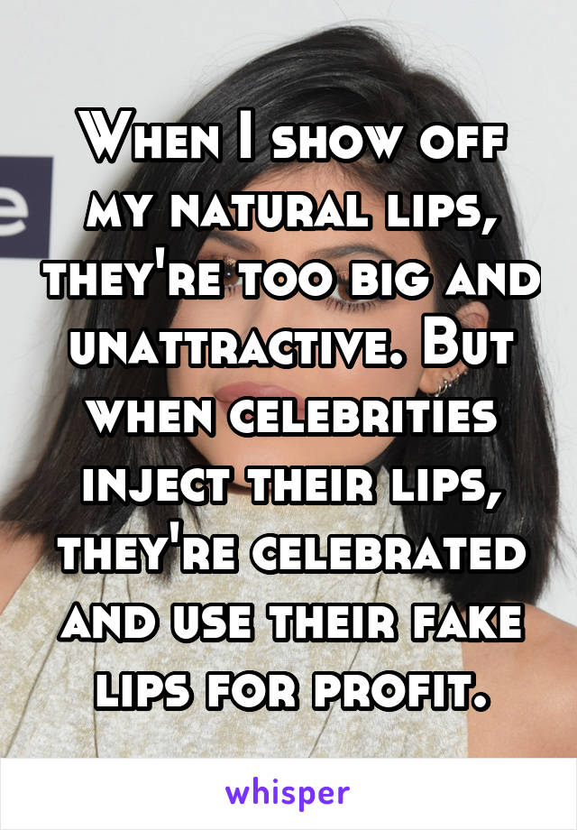 When I show off my natural lips, they're too big and unattractive. But when celebrities inject their lips, they're celebrated and use their fake lips for profit.