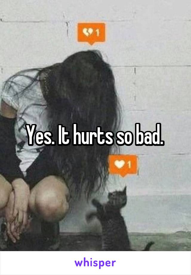 Yes. It hurts so bad. 