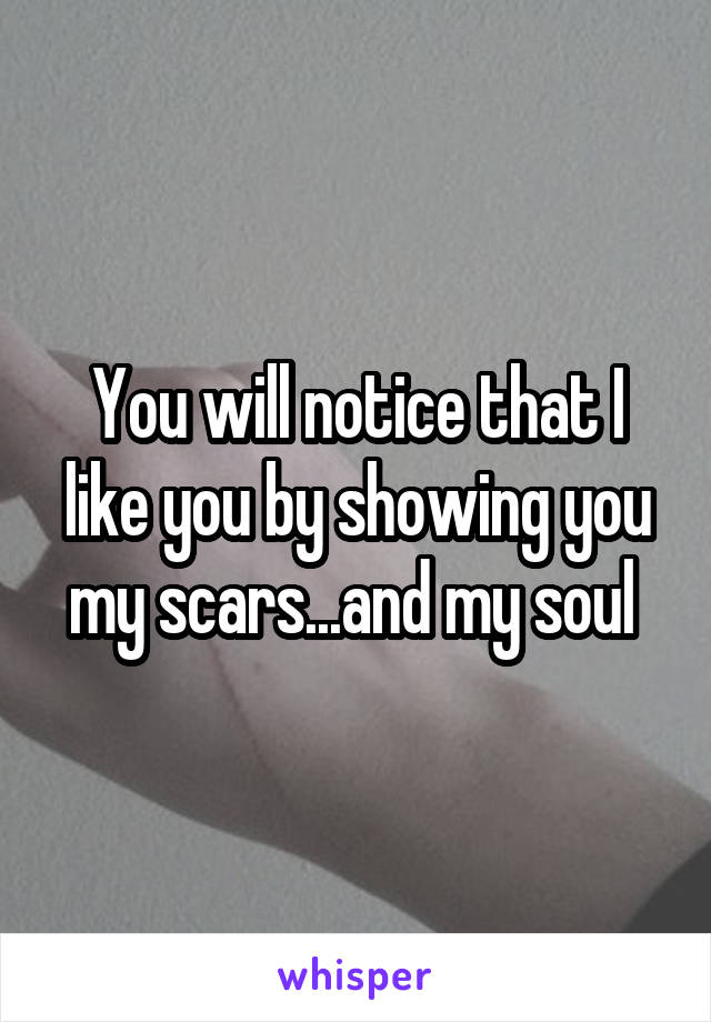 You will notice that I like you by showing you my scars...and my soul 