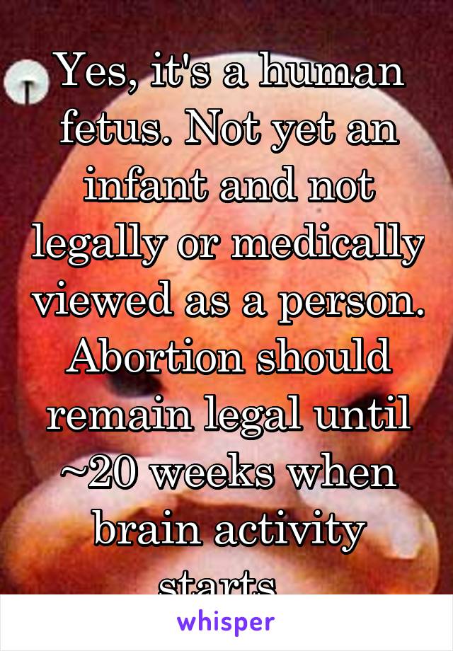 Yes, it's a human fetus. Not yet an infant and not legally or medically viewed as a person. Abortion should remain legal until ~20 weeks when brain activity starts. 
