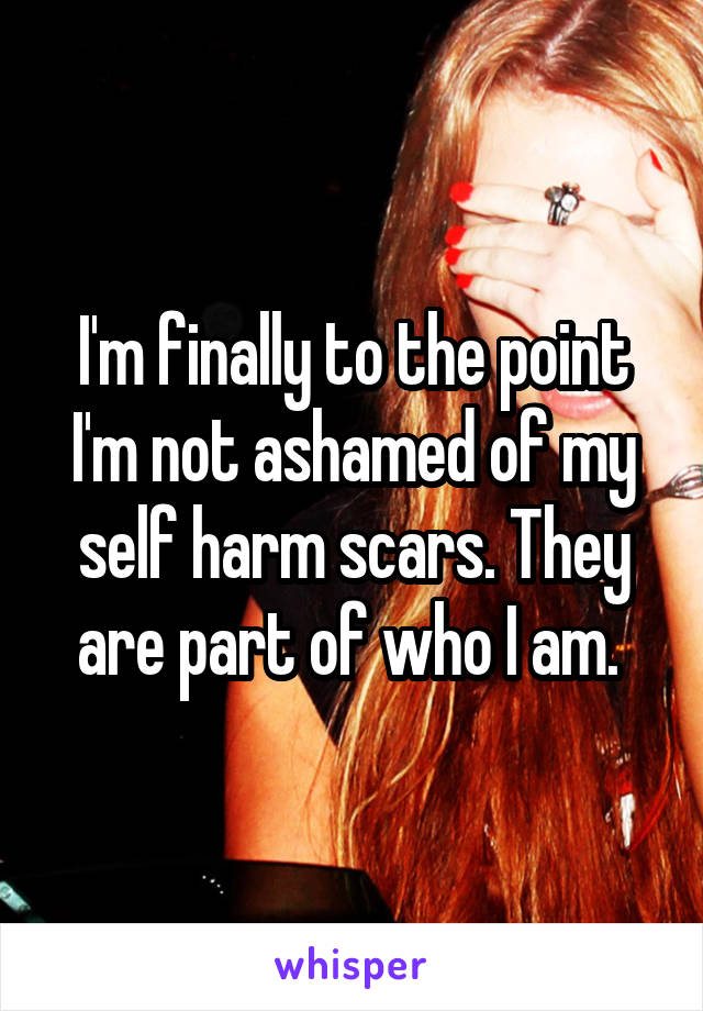 I'm finally to the point I'm not ashamed of my self harm scars. They are part of who I am. 