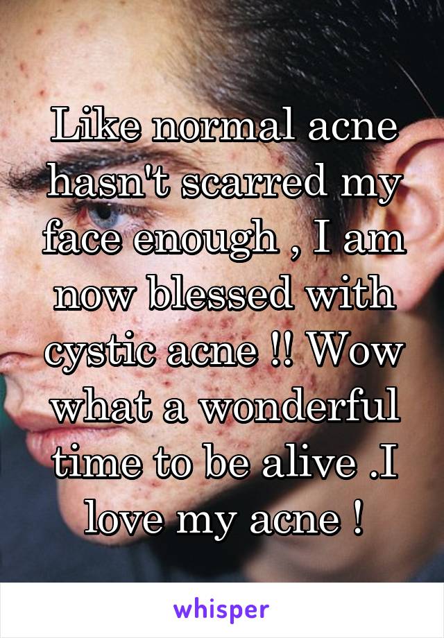 Like normal acne hasn't scarred my face enough , I am now blessed with cystic acne !! Wow what a wonderful time to be alive .I love my acne !