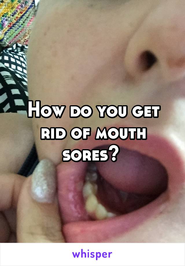 How do you get rid of mouth sores? 