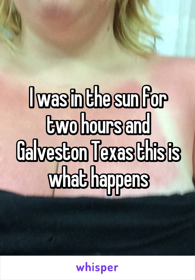 I was in the sun for two hours and Galveston Texas this is what happens