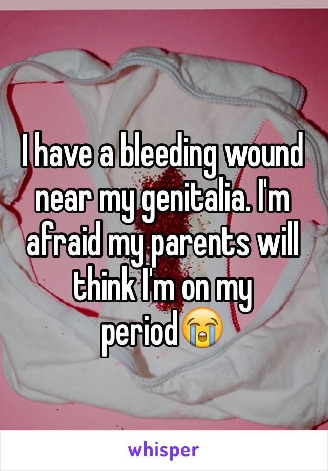 I have a bleeding wound near my genitalia. I'm afraid my parents will think I'm on my period😭