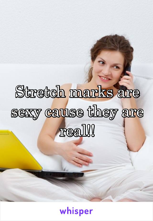 Stretch marks are sexy cause they are real!!