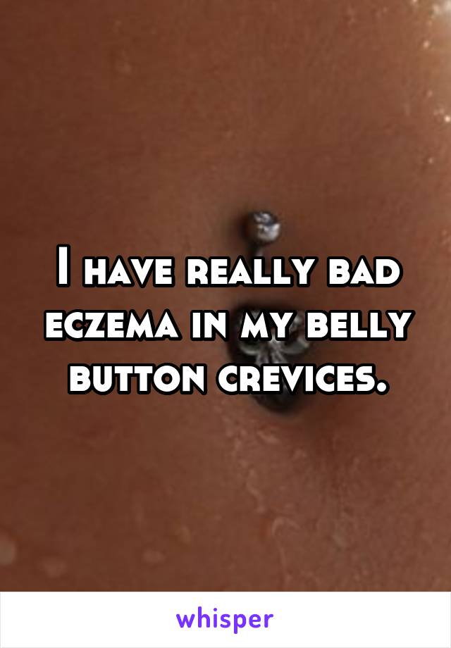 I have really bad eczema in my belly button crevices.