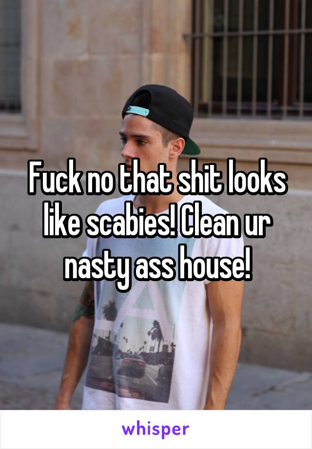 Fuck no that shit looks like scabies! Clean ur nasty ass house!