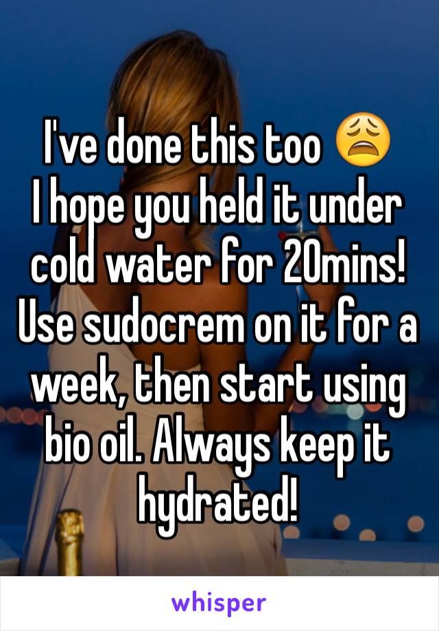 I've done this too 😩 
I hope you held it under cold water for 20mins! 
Use sudocrem on it for a week, then start using bio oil. Always keep it hydrated! 