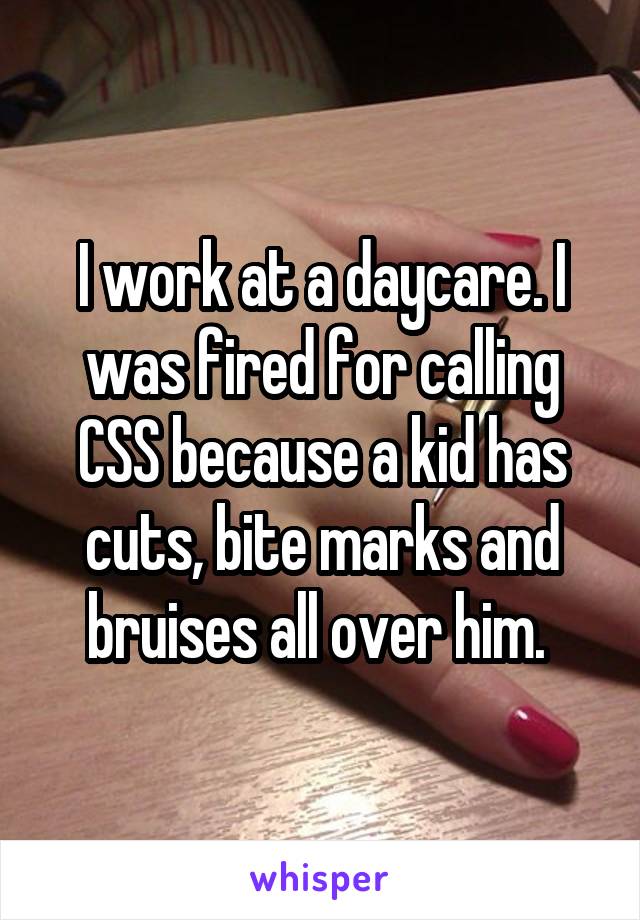I work at a daycare. I was fired for calling CSS because a kid has cuts, bite marks and bruises all over him. 