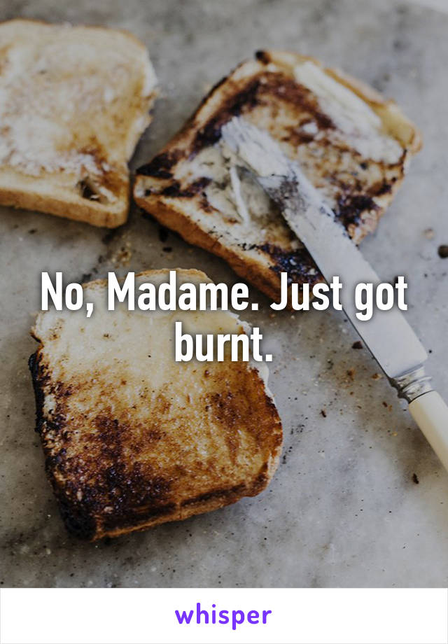 No, Madame. Just got burnt.