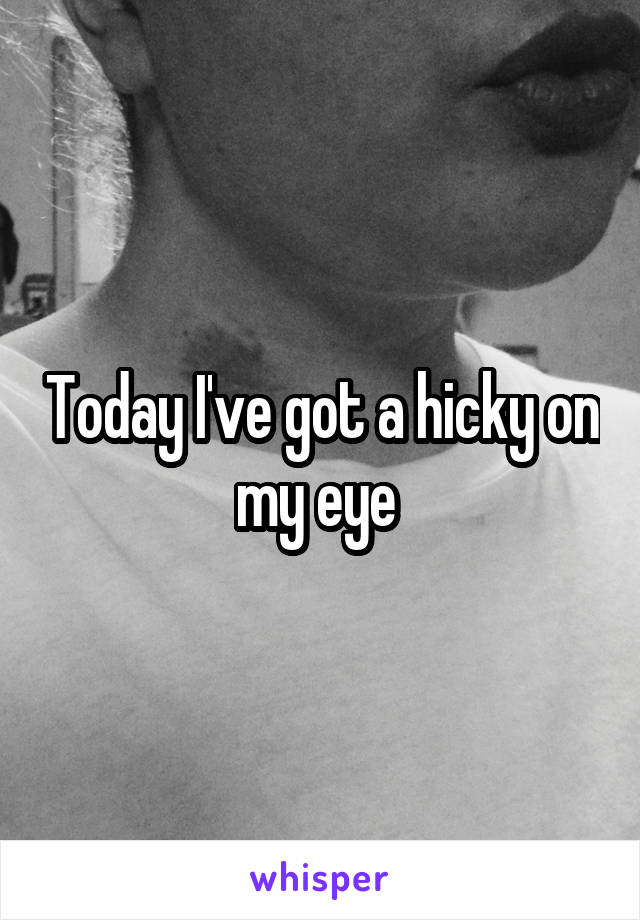 Today I've got a hicky on my eye 