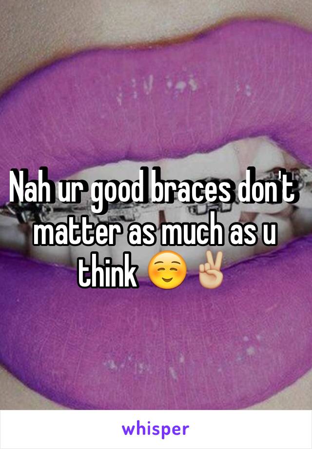 Nah ur good braces don't matter as much as u think ☺️✌🏼️