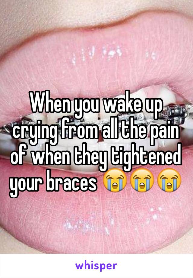 When you wake up crying from all the pain of when they tightened your braces 😭😭😭