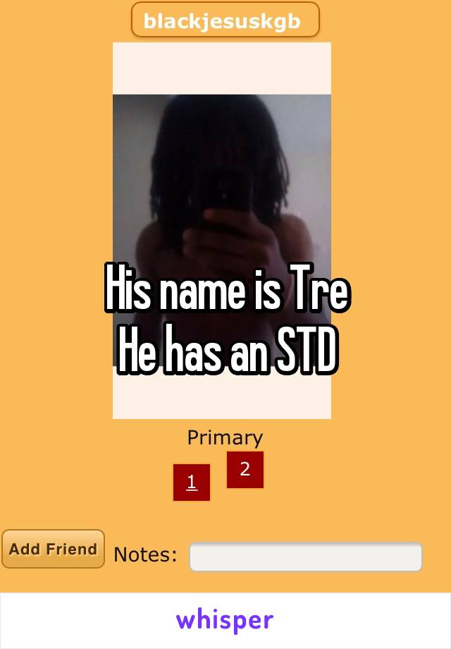 His name is Tre
He has an STD