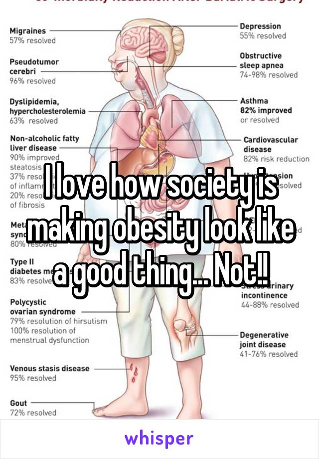 I love how society is making obesity look like a good thing... Not!!