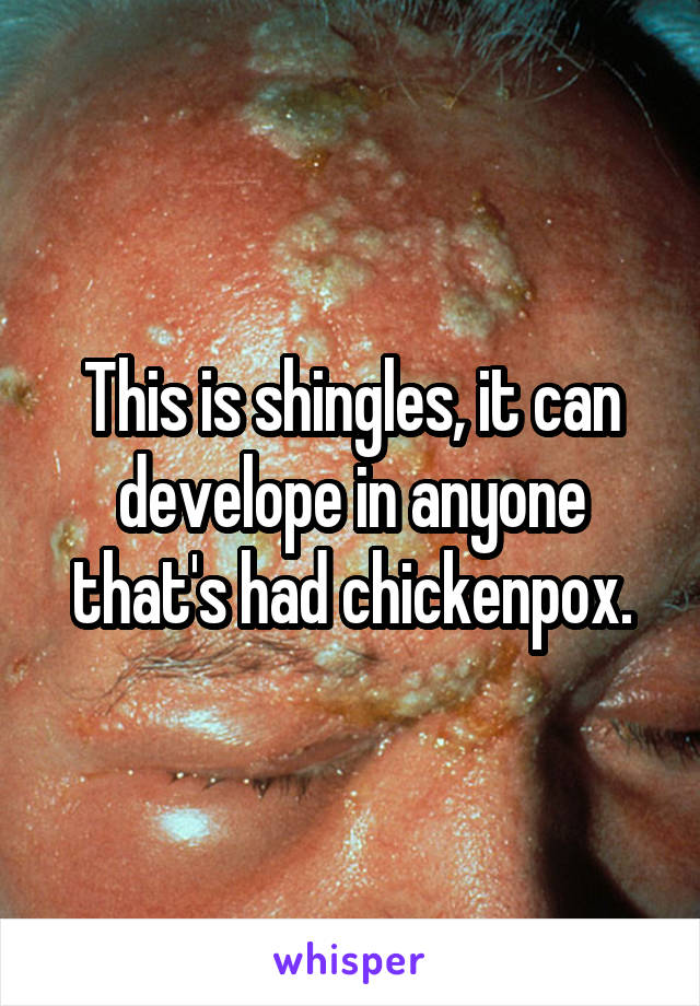 This is shingles, it can develope in anyone that's had chickenpox.