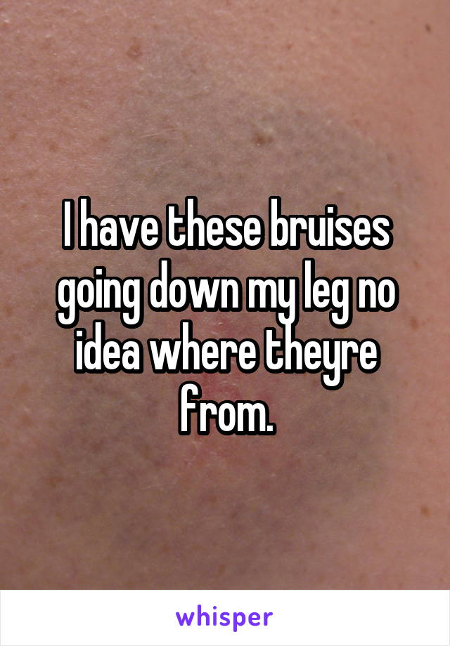 I have these bruises going down my leg no idea where theyre from.