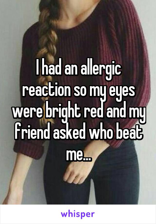 I had an allergic reaction so my eyes were bright red and my friend asked who beat me...