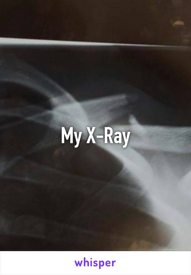 My X-Ray