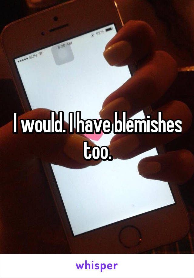 I would. I have blemishes too.